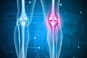 Ρομποτική Αρθροπλαστική Ισχίου