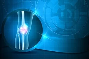Ρομποτική Αρθροπλαστική Γόνατος