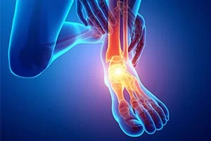 Αρθροσκόπηση Ποδοκνημικής